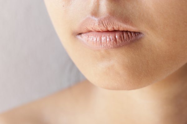 7 Cara Membedakan Bibir Kering karena Dehidrasi atau Alergi