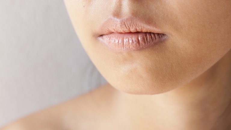7 Cara Membedakan Bibir Kering karena Dehidrasi atau Alergi