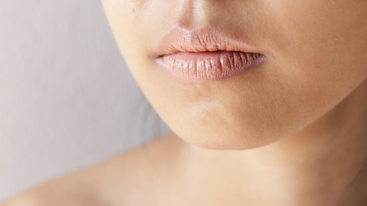 7 Cara Membedakan Bibir Kering karena Dehidrasi atau Alergi