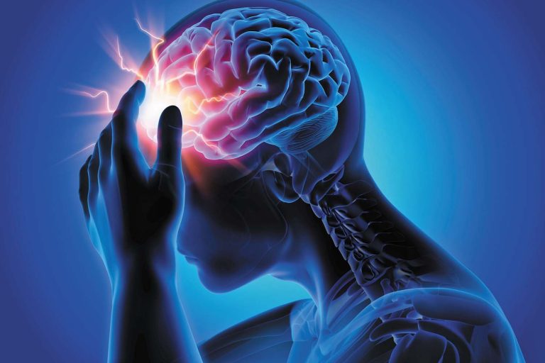 7 Cara Menghindari Sakit Kepala Akibat Postur Kepala yang Buruk