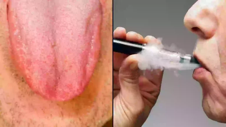 5 Cara Menjaga Lidah Bagi Perokok Aktif