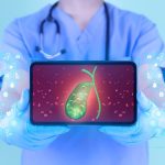 7 Cara Mudah Menjaga Kesehatan Kantong Empedu untuk Semua Usia