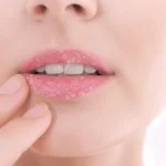 10 Cara Mengatasi Bibir Mengelupas dengan Bahan Dapur