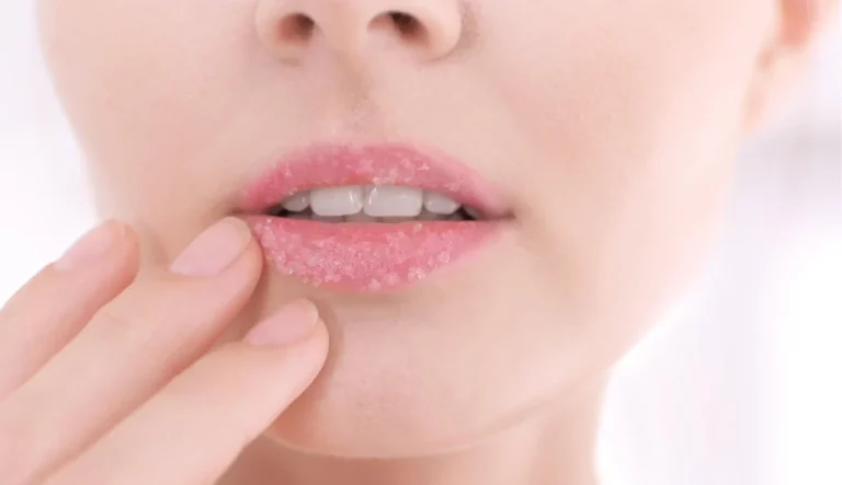 10 Cara Mengatasi Bibir Mengelupas dengan Bahan Dapur